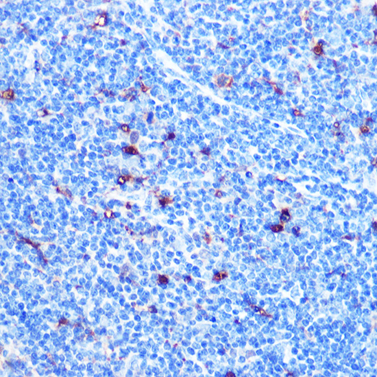 FGF21 Rabbit monoclonal antibody