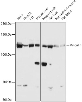 Vinculin Rabbit monoclonal antibody