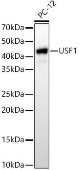 [KD Validated] USF1 Rabbit monoclonal antibody
