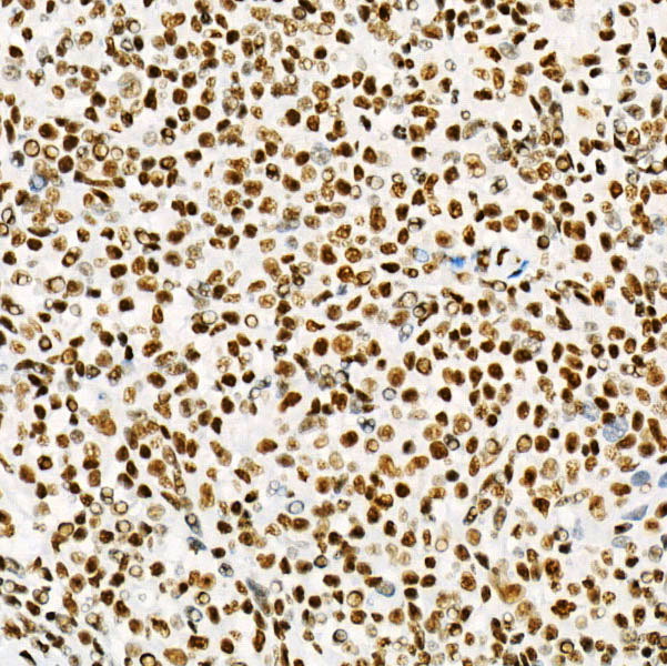 [KD Validated] USF1 Rabbit monoclonal antibody