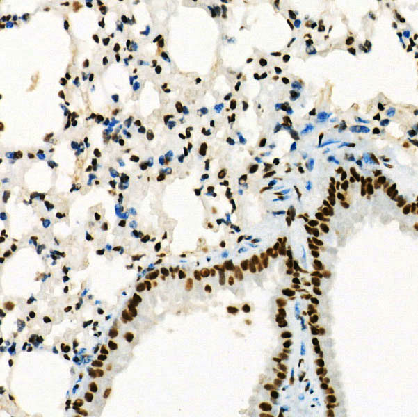 [KD Validated] USF1 Rabbit monoclonal antibody