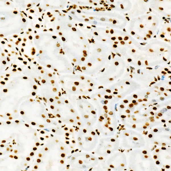 [KD Validated] USF1 Rabbit monoclonal antibody