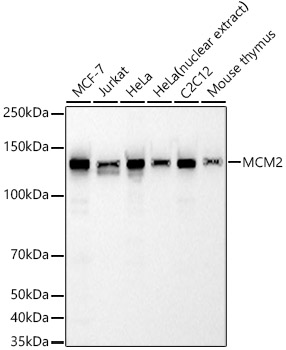 MCM2 Rabbit monoclonal antibody