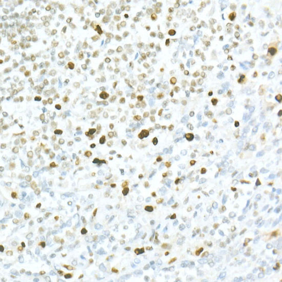 MCM2 Rabbit monoclonal antibody