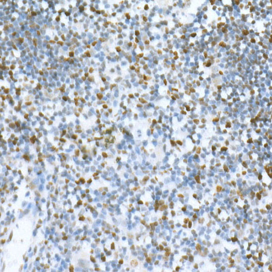 MCM2 Rabbit monoclonal antibody