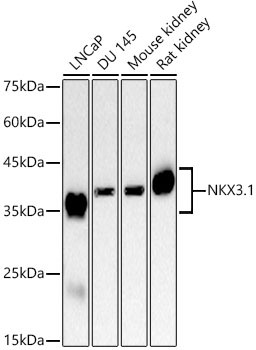NKX3.1 Rabbit monoclonal antibody