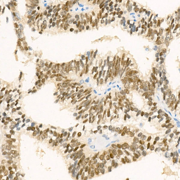 NKX3.1 Rabbit monoclonal antibody