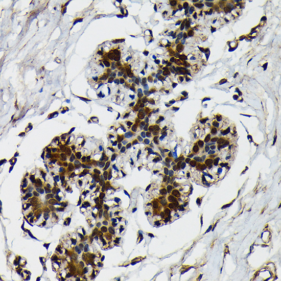 Ubiquitin Rabbit monoclonal antibody