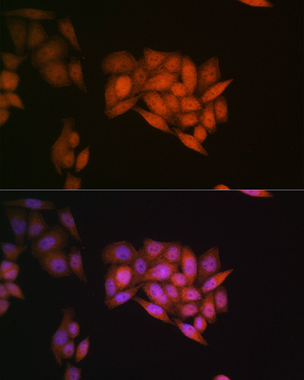 Ubiquitin Rabbit monoclonal antibody