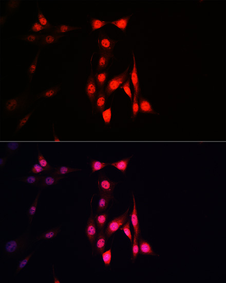 Ubiquitin Rabbit monoclonal antibody
