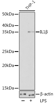 IL1B Beta Rabbit monoclonal antibody