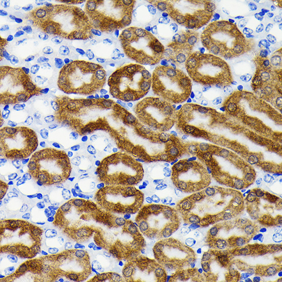 NQO1 Rabbit monoclonal antibody