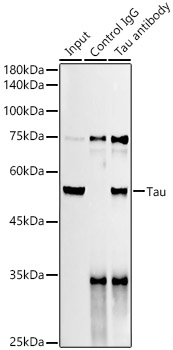 ABclonal:Immunoprecipitation - Tau Rabbit mAb (A23490)