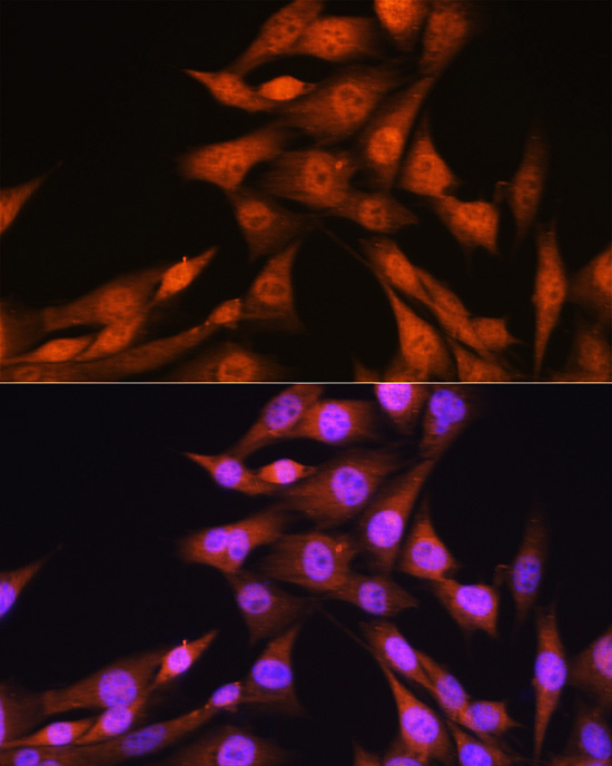 [KO Validated] Smad1 Rabbit monoclonal antibody