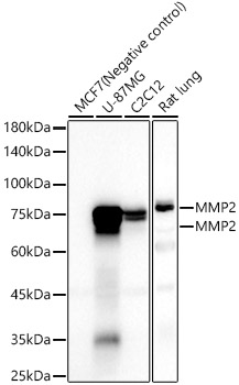 MMP2 Rabbit monoclonal antibody