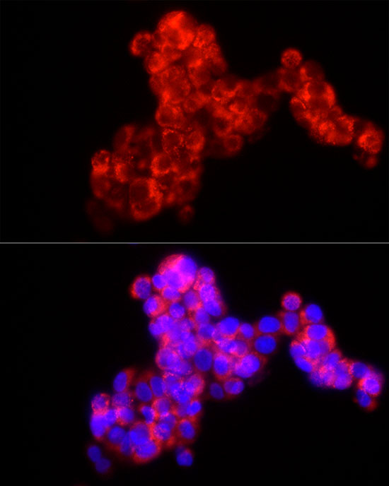 MMP2 Rabbit monoclonal antibody
