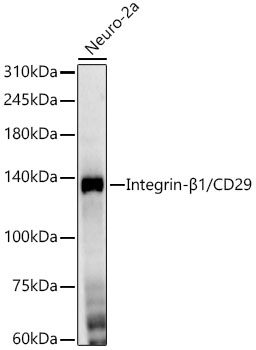 Integrin-β1/CD29 Rabbit mAb