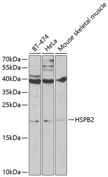 HSPB2 Rabbit polyclonal antibody