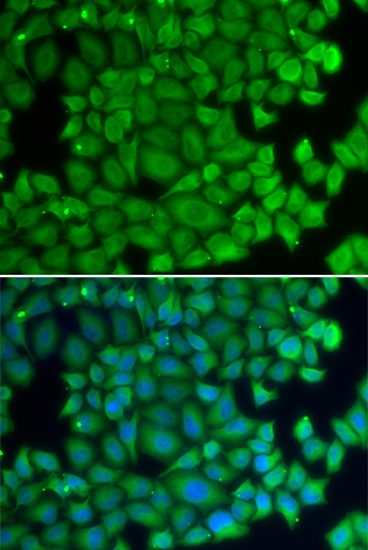 HSPB2 Rabbit polyclonal antibody