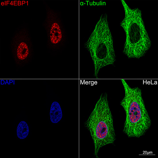 [KD Validated] eIF4EBP1 Rabbit monoclonal antibody