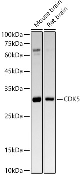 [KO Validated] CDK5 Rabbit monoclonal antibody