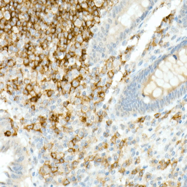 CD19 Rabbit monoclonal antibody