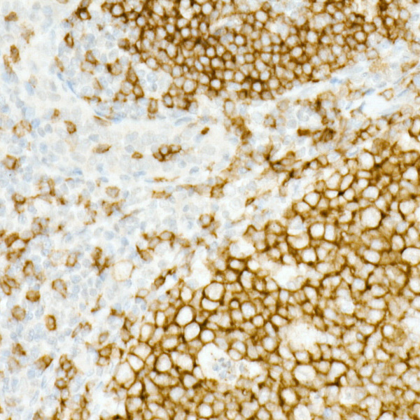 CD19 Rabbit monoclonal antibody