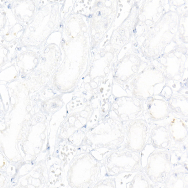 CD19 Rabbit monoclonal antibody