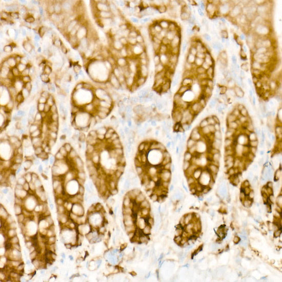eIF4A1 Rabbit monoclonal antibody