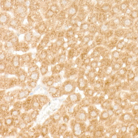 eIF4A1 Rabbit monoclonal antibody