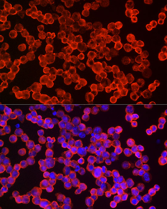 eIF4A1 Rabbit monoclonal antibody