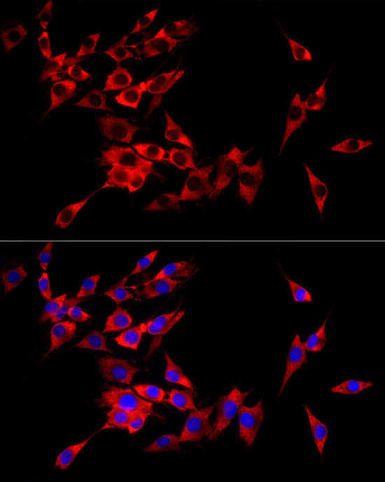 eIF4A1 Rabbit monoclonal antibody