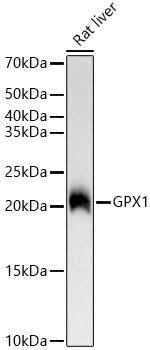 GPX1 Rabbit monoclonal antibody