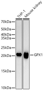 GPX1 Rabbit monoclonal antibody