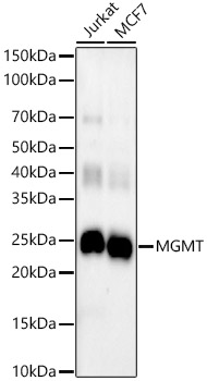 MGMT Rabbit monoclonal antibody