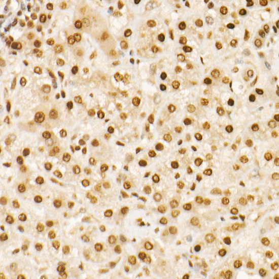 MGMT Rabbit monoclonal antibody