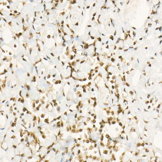MGMT Rabbit monoclonal antibody