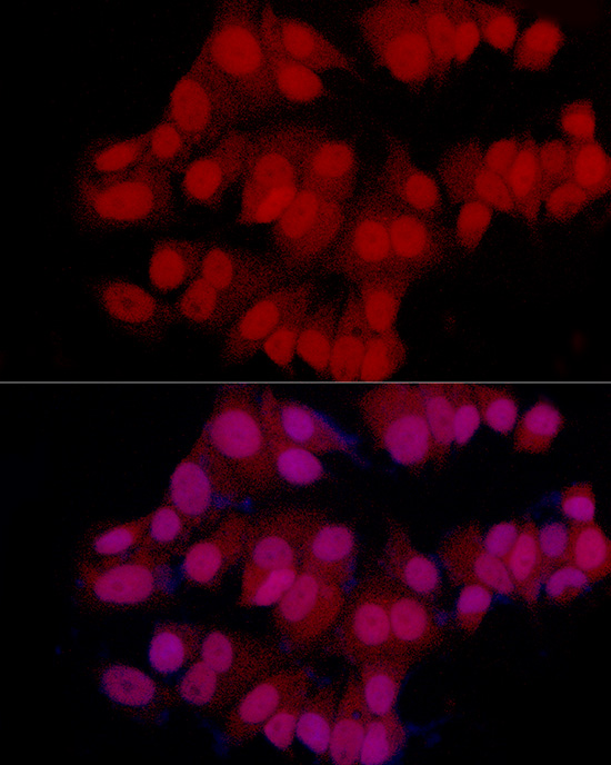 MGMT Rabbit monoclonal antibody