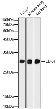 CDK4 Rabbit monoclonal antibody