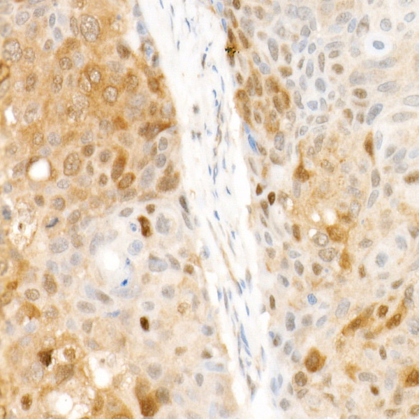 CDK4 Rabbit monoclonal antibody