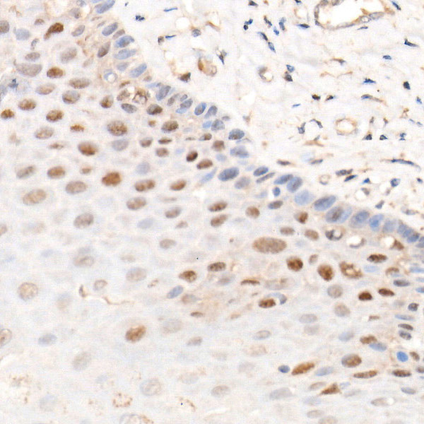 CDK4 Rabbit monoclonal antibody