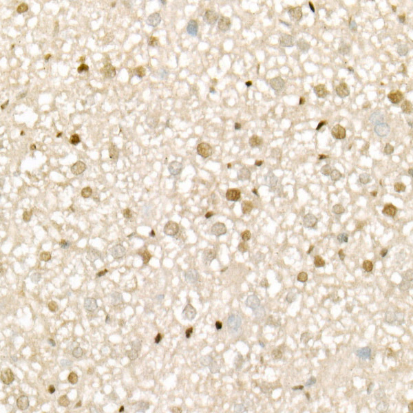 CDK4 Rabbit monoclonal antibody