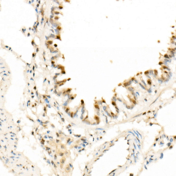 CDK4 Rabbit monoclonal antibody