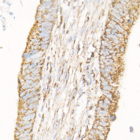 Bak Rabbit monoclonal antibody