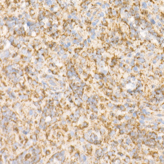 Bak Rabbit monoclonal antibody