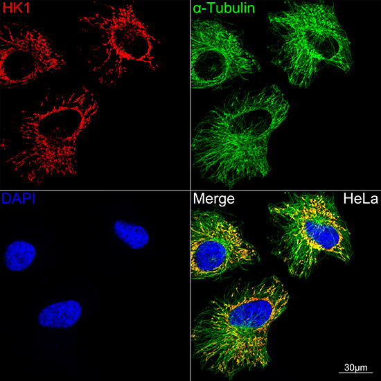 HK1 Rabbit monoclonal antibody