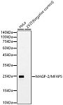 Western blot - MAGP-2/MFAP5 Rabbit mAb (A23529)