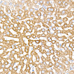 Immunohistochemistry - INSIG1 Rabbit mAb (A23531)