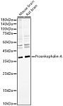 Western blot - Proenkephalin-A Rabbit mAb (A23532)