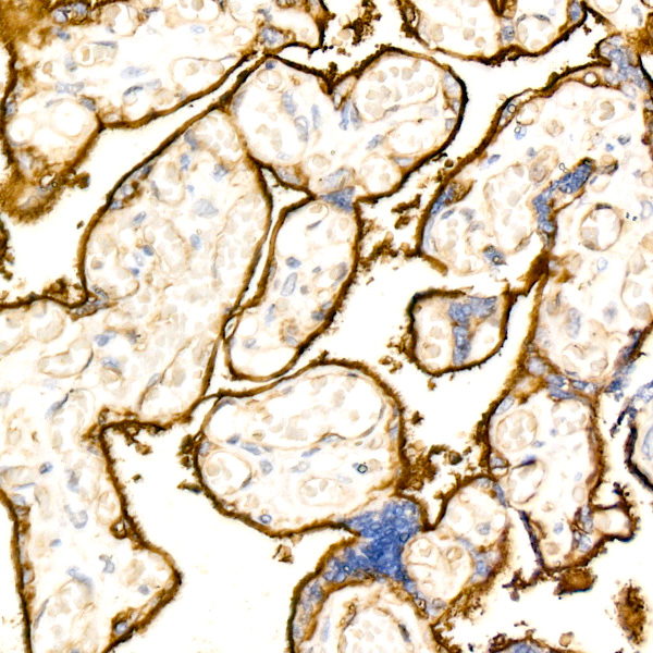 CD200 Rabbit monoclonal antibody